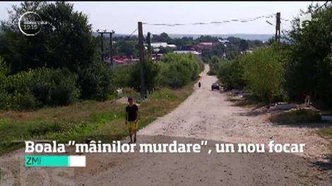 Focar de hepatita A în judeţul Dolj. 13 copii au fost deja trataţi la spital, iar alţii sunt şi acum bolnavi acasă, fără ca autorităţile să ia măsuri