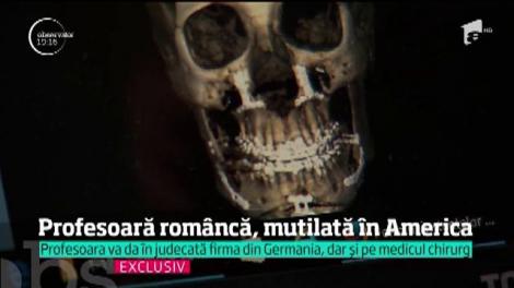 O operaţie în America a mutilat o româncă. Femeia spune că medicii i-au fracturat mandibula