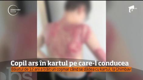 Un băieţel de 12 ani a suferit arsuri grave, în timp ce kartul în care se afla a fost cuprins de flăcări