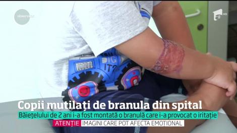 Un copil de doi ani are braţul drept infectat din cauza unei branule puse la spitalul din Slatina