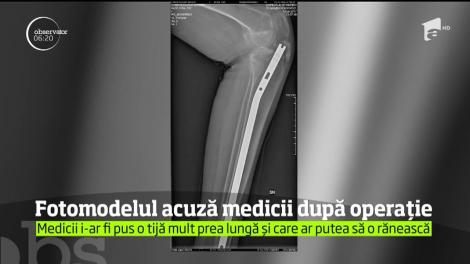 Magda Coman, modelul în scaun cu rotile, îi acuză pe medicii de la Floreasca de nepăsare