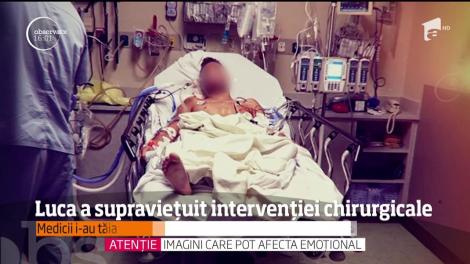 Luca a supravieţuit intervenţiei chirurgicale