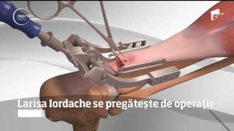 Larisa Iordache se pregătește de operație! Gimnasta a suferit o ruptură a tendonului lui Ahile