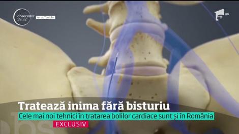 Medicina viitorului se practică şi în România! Medicii salvează inimi fără bisturiu