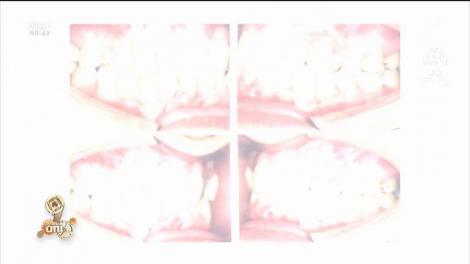 Secretele spre un zâmbet ca la Hollywood