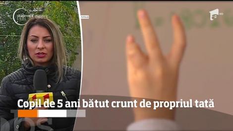 Caz şocant în Focşani. Un băiat de doar cinci ani a ajuns la spital bătut crunt. Nu dați click dacă sunteți sensibili: sunt imagini care vă pot afecta emoțional!