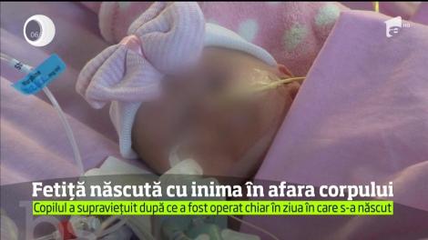 O fetiţă din Marea Britanie a fost salvată de medici după ce s-a născut cu inima în afara corpului