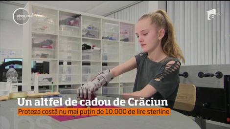 Un altfel de cadou de Crăciun. Un băieţel din Marea Britanie va primi o mână bionică