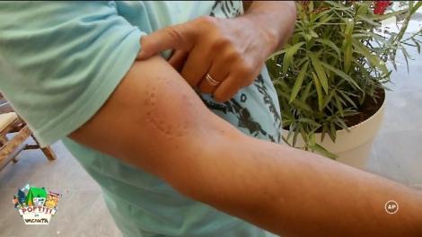 S-au bătut parte în parte! Dinții lui Liviu Vârciu i-au lăsat urme adânci pe brațul lui Nea Mărin: ”Am crezut că leșin de durere!”