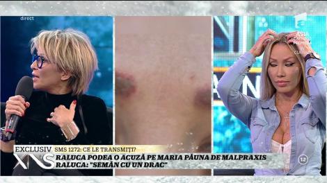 Raluca Podea își demachiază sprâncenele distruse în direct: ”Asistenta a încercat să mi le coboare, dar....”