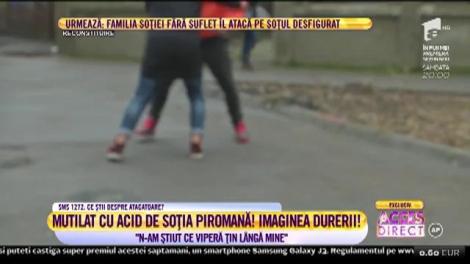 Drama terifiantă a bărbatului desfigurat de acidul din inima soție, în exclusivitate, la Acces Direct!