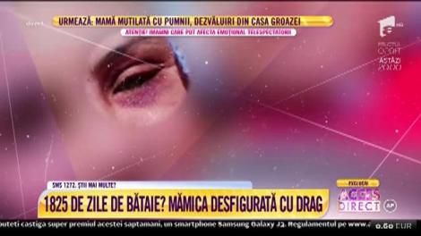 Tânără mămică, desfigurată, cu bebelușul în brațe. La 24 de ani, îi este groază să se privească în oglindă: "Are carnea umflată, putredă. Are sânge în ochi"