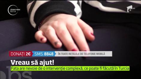 Vreau să ajut! Alexandra suferă de un sindrom extrem de rar care i-a provocat o malformație arterio-venoasă la față