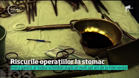 Riscurile operațiilor la stomac. Israela Vodovoz, ucisă de un inel gastric montat în urmă cu aproape 20 de ani