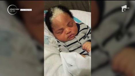 Primul bebeluş grizonant. Fotografiile cu el fac înconjurul lumii, pe Internet