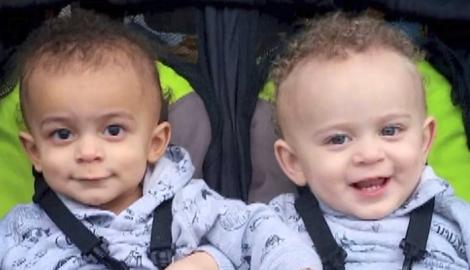 Prima lor imagine i-a șocat și pe medici! Unul alb, ca laptele, celălalt de culoare: Gemenii au devenit vedete pe internet