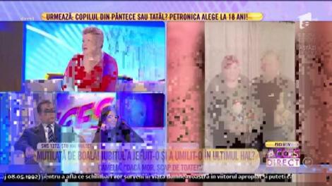 Mutilată de boală, iubitul ar fi jefuit-o! Camelia: ”Dacă mor, scap de toate!”