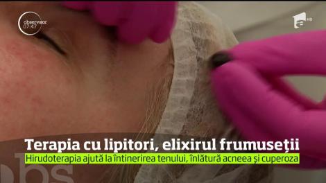 Uitaţi de vizitele la estetician şi încercaţi tratamentul cu lipitori!