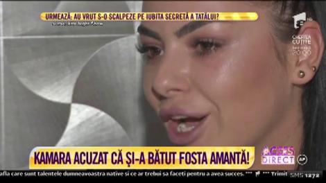 Imagini ȘOC! Kamara, acuzat că și-a bătut fosta amantă! Mădălina: „Mă târa de păr, prin casă!”