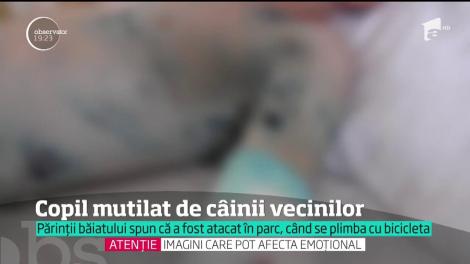 Copil de nouă ani mutilat de câinii vecinilor