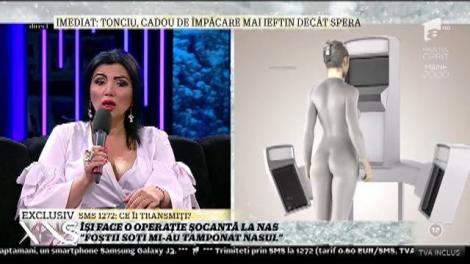 Adriana Bahmuțeanu își face o operație șocantă la nas: „Îmi scot os din coastă și îl pun la nas”