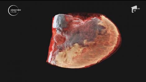 Premieră în lumea medicală. Oamenii de ştiinţă din Noua Zeelandă au realizat prima radiografie 3D color asupra unui om
