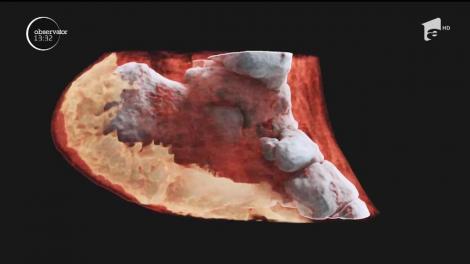 Premieră în lumea medicală. Oamenii de ştiinţă din Noua Zeelandă au realizat prima radiografie 3D color asupra unui om
