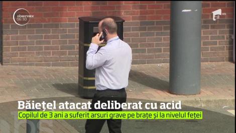 Caz şocant în Marea Britanie. Copil de trei ani atacat deliberat cu acid