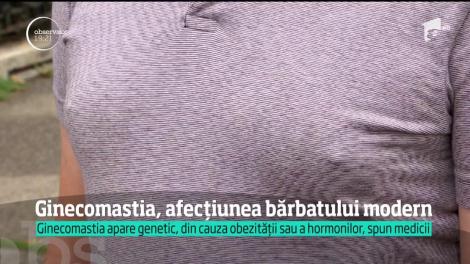 Ginecomastia, afecțiunea bărbatului modern