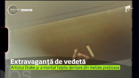 Artistul Drake și-a montat fațete dentare din metale prețioase