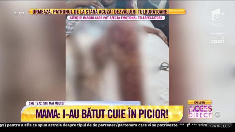 Torturat ca în Evul Mediu şi aruncat cu animalele, un tânăr a ajuns LEGUMĂ: "I-au bătut cuie în picioare". Imagini cu puternic impact emoţional!