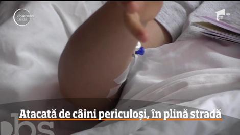 O femeie din Arad a fost atacată de doi câini cu potenţial agresiv, care ar fi fost eliberaţi în stradă intenţionat de cineva, ca să-i facă rău proprietarului lor
