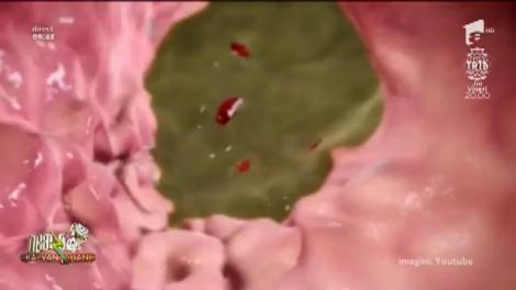 Bună dimineață, Sănătate! Problemele digestive, boala omului modern! Iată cum le putem combate