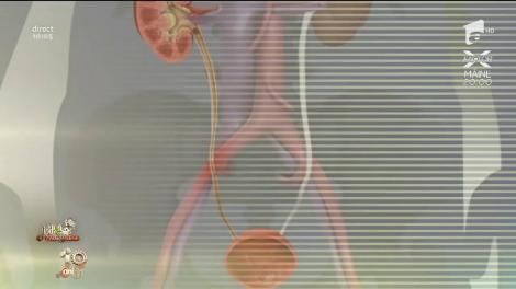 Bună dimineața, Sănătate! Durerile cauzate de pietrele ce se pot forma la rinichi