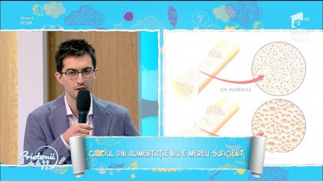 Crampele musculare și cârceii pot indica o deficiență de calciu. Ce sfaturi ne dau specialiștii