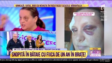 Pumni și picioare în față! Mama Rodica susține că soțul i-a spart arcada: "Nu e prima dată când mă bate"