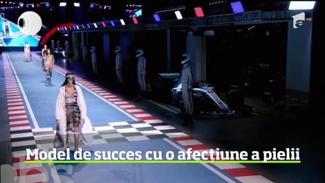 Frumuseţea este uneori atipică, iar în ultimii ani, din ce în ce mai mulţi designeri aleg să lucreze cu modele ieşite din tiparele clasice