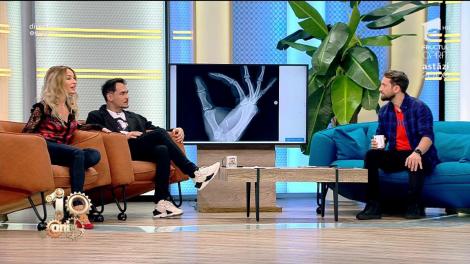 Mii de oameni își implantează microcipuri sub piele! De ce au ajuns să facă asta și cum îi recunoști