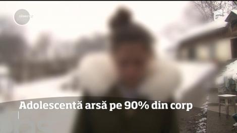 O adolescentă de 16 ani, din Bacău, se luptă să trăiască după ce a suferit arsuri extrem de grave în urma unui incident