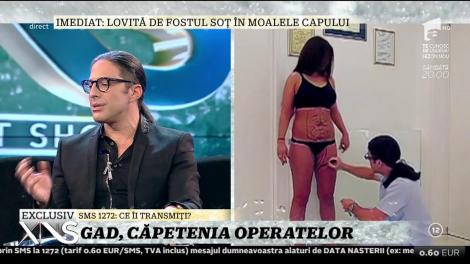 Doctorul estetician Renert Gad, poreclit Winnetou de presa mondenă