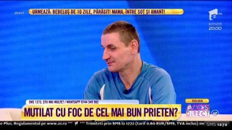 A ars ca o torță ca să o salveze pe femeia care l-a părăsit cât era încă pe patul de spital! „Mi-a zis că o să-mi dea foc, iar eu spus că voi trece prin el!”