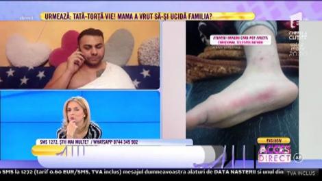 Schingiuit chiar în prima zi din an! Un tânăr de 25 de ani  susţine că a fost bătut şi abandonat în pădure