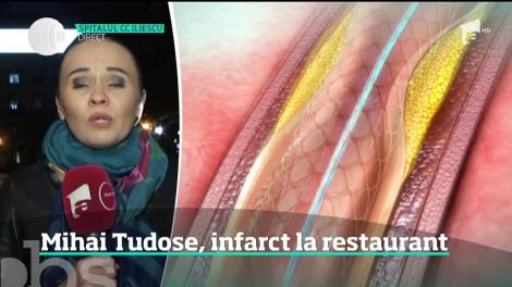 Fostul premier, Mihai Tudose, a suferit un infarct