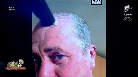 Smiley News. Aspiratorul, cea mai bună metodă de a rămâne fără păr pe cap