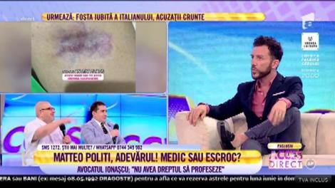 Matteo Politi, dezvăluiri incendiare la Acces Direct: Am studiat chirurgia cosmetică