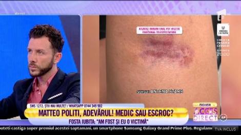 Matteo Politi și-a mutilat fosta iubită! Ioana: M-a făcut să cred că sunt bolnavă de cancer