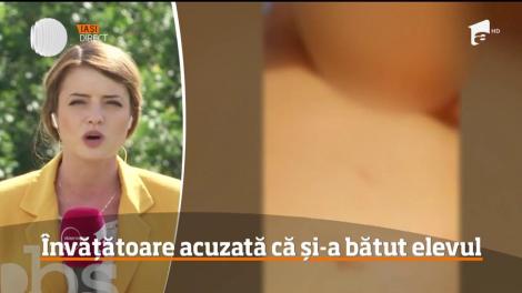 Învățătoare din Botoşani acuzată că și-a bătut elevul până l-ar fi învineţit