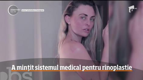 O femeie din Marea Britanie a mințit sistemul medical pentru o operație plastică la nas