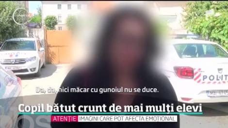 Copil bătut crunt de mai mulți elevi pe o stradă din Cugir. Mama victimei a depus plângere la Poliţie