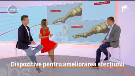 Ce sunt monturile și din ce cauză apar. Care sunt dispozitivele pentru ameliorarea afecțiunii